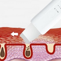 아쿠아필 아쿠아필 워터필링기 아쿠아필링기 스크러버 필링 워터필링기, 본상품선택, 본상품선택