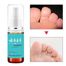 무좀 스프레이 약 발톱 각질 발바닥 발가락 간지럼 발 관리 풋케어, 55ml, 1개