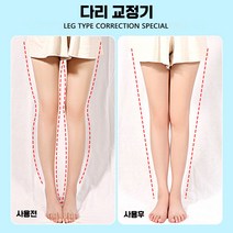 오다리 O자형 X자다리 교정기 휜다리 종아리성형, 어린이 디럭스] XO(종아리 외반)+자석 2쌍