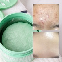 착한팩토리 트러블 모공 진정 각질 피지 센텔라시카 90% 리얼 토너패드, 1.센텔라시카 90% 리얼 토너패드 1개, 1개, 70매