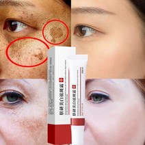 BT 기미 제거 크림 효과적인 미백 주근깨 크림 잡티 앤 다크 스팟 검버섯 리페어 크림 피부 복구, 20g, 1개