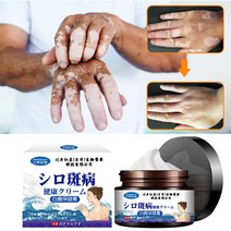 백반증 피부치료 연고 반점제거 손 목 얼굴 백반증치료, 30ml, 1개