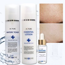 스킨아이 AC 퓨어 워터리 토너 + 에센셜 로션 세럼 SET (여드름 기초 스킨케어 3종 SET), 1set
