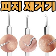코피지 제거기 얼굴여드름 압출기 블랙헤드 뽑기 압출, L형