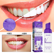 치아미백제 화이트닝 구취케어 구강 누렁니 제거 제 폼, 1개, 45ml