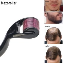 mezoroller 수염 더마 롤러 drs 540 니들 마이크로 니들링 롤러 모발 재생 스킨 케어 바디 트리트먼트 microniddle mts, 크기를 알려주세요