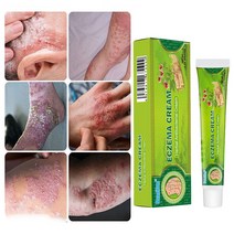 피부 가려움증 연고 습진 모낭염 두피 건선연고 지루성피부염 치료, 20ml, 1개