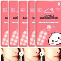 홈메디케어 스팟패치 48매X5개, 5개