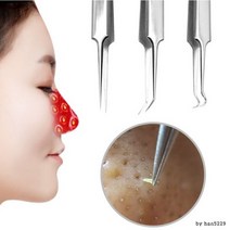 코피지 뽑기 압출 피지 제거기 얼굴 블랙헤드 압출기, 바늘루프형