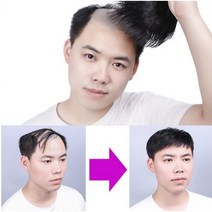 남자 원형 가발 정수리 똑딱이가발 M자커버 자연스러운 엠자이마 탈모가발, 자연가르마