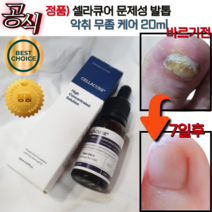 [공식] 리뉴얼 닥터로운 셀라큐어 20mI 1개입 문제성 발톱 무좀 관리 셀라솔루션 닥터로운셀라큐어 문제성발톱 티트리 뉴리트리언트 믹스, 20ml