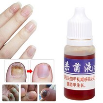 네일영양제 손 발 네일 톱 강화 케어 연화 제 영양 오일 10ml 발 관리 곰팡이 손톱 액체 진균증 미백 발가, 01 10ml