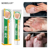 건선 피부건선 피부 발진 피부 붉은반점 피부 가려움증, 20g, 1개