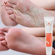 발 바닥 손 발톱 풋 각질 굳은살 케어 제거 크림 스프레이 냄새 크림 관리 건조 방지 뒤꿈치 갈라진