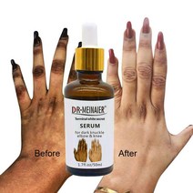 세럼50ml Strong Effective Whitening Serum Removing Dark Knee Hand Essence Elbow Joint Brightening Li, 01 50ml