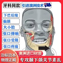 안면비대칭 마스크 얼굴 측두 하악 관절 장애 기 입 열기 하늘 크기 모양 턱 수축을 덮기 위해 부분 스냅, TMJ/D(남성)