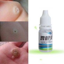 발각질 제거기 10ml 피트 스킨 케어 옥수수 엑스 폴리 에이 팅 캘러스 아이 트리트먼트 액체 솔루션 힐 코쿤 Painless Massage, 01 B