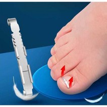 자리관리 교정 팁 내성발톱 엄지발가락 자가, (포지티브 아머 버클 2개 팩) 향상된 버전