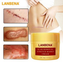 나이트 크림 달팽이크림 수분 영양 슬리핑 수면 탄력 바르는 콜라겐 란베나 흉터 제거 여드름 치료 리페어링 흉터 블랙헤드 수축 모공 화이트닝 모이스춰라이징 스킨 케어 40g