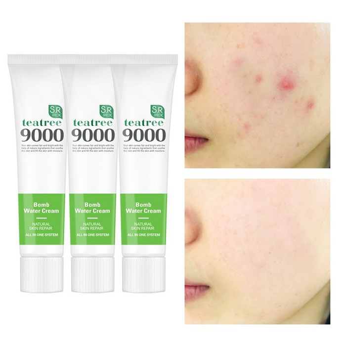 에스알픽 트러블 자국 강력보습 모공수축 티트리폭탄 수분크림 50ml, 3개, 50ml
