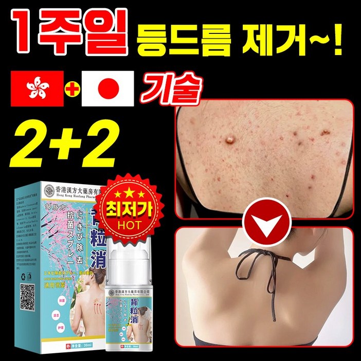 [국내배송] 1/1+1/2+2 등드름 바디 미스트 스프레이 등드름없애는법 등 가슴 여드름 등관리