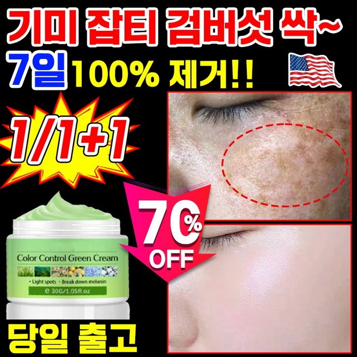 당일배송 111 기미 미백 화이트닝 크림 기미 잡티 검버섯 흑자 주근깨 반점 제거 크림 색소침착 케어 개선 240시간 탄력 보습 피부장벽 멜리닌색소 주름개선 당일배송 111 기미 미백 화이트닝 크림 기미 잡티 검버섯 흑자 주근깨 반점 제거 크림 색소침착 케어 개선 240시간 탄력 보습 피부장벽 멜리닌색소 주름개선