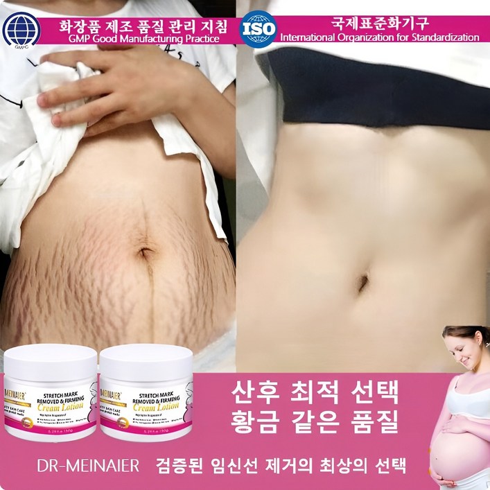 임신 크림 Stretch Mark Cream 임신부 바디 로션 산후 크림, 5개, 150g