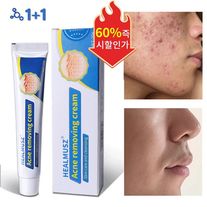 [당일배송] 여드름 연고 여드름 치료 스킨 배리어 리커버리 수부지 관리 크림