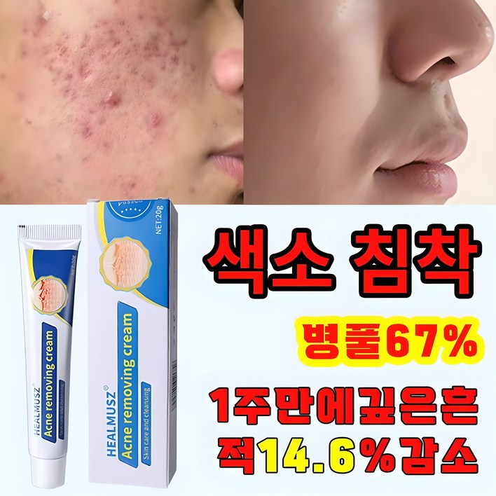 국내배송 병풀추출물 여드름 레티놀 여드름 연고 리페어 연고 진정 피지케어 크림 흉터 치료 자생 관리후 점뺀후 크림 발효 재생크림샤블 나이아신아마이드 레티놀 펩타이드크림, 1개, 20g