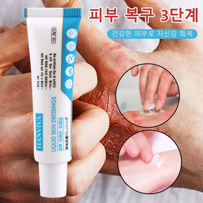 국내배송 피부 건선 피부 가려움증 여드름 습진 두드러기 발진 허브 연고 피부염 에좋은연고 피부 케어 보습 크림
