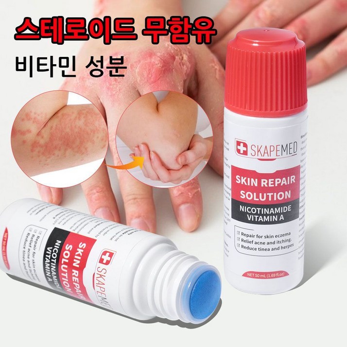 습진 크림 비타민A 피부 가려움 관리 헤르페스 건선 피부 가려움 케어 로션 피부진정크림, 1개, 50ml 습진 크림 비타민A 피부 가려움 관리 헤르페스 건선 피부 가려움 케어 로션 피부진정크림, 1개, 50ml