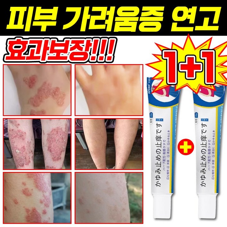 [일본 기술] 피부 가려움증 연고 건선 연고 습진 치료제 모낭염 연고 지루성 피부염 각종 피부 트러블 곰팡이균 볽은반점 완화 크림