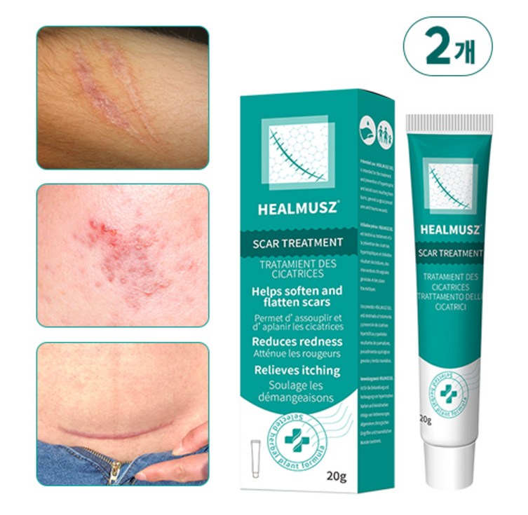 HEALMUSZ 흉터제거연고 피부흉터 수술흉터 제거 화상 상처 흉터 흉터재생 관리 겔, 2개, 20ml